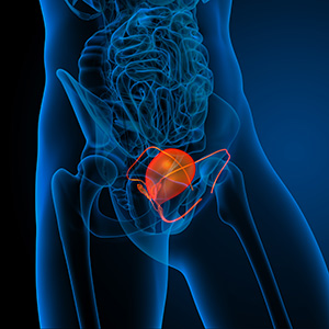 Bladder Problems Mens Health Advanced Urology Institute